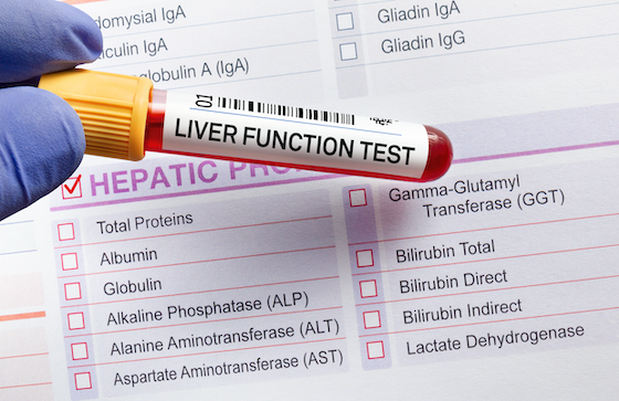 Interpretation of liver enzymes and liver function tests