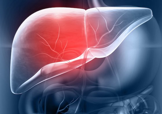 Understanding the transjugular intrahepatic portosystemic shunt (TIPS) procedure.