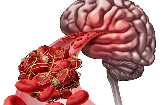 Alteplase – how does it work?
