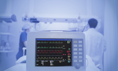 Pulmonary vascular resistance