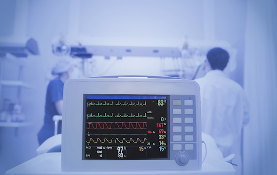 Pulmonary vascular resistance