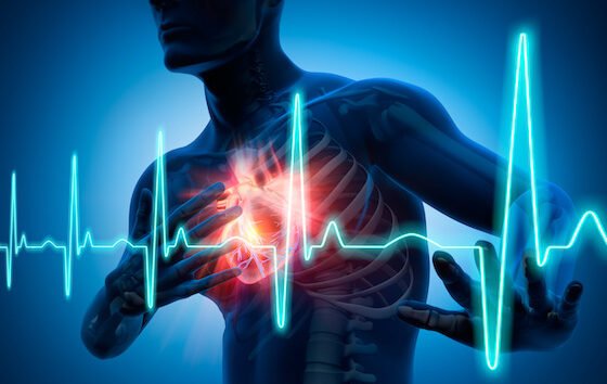 Antianginal drugs – how do they work?