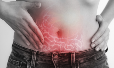 Appendicitis Supplement: Learn the symptoms of appendicitis