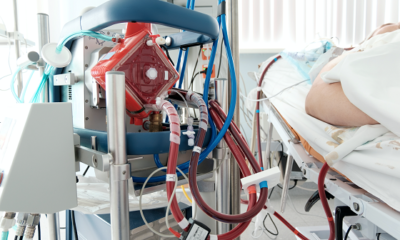 Basics of Extracorporeal Membrane Oxygenation (ECMO)