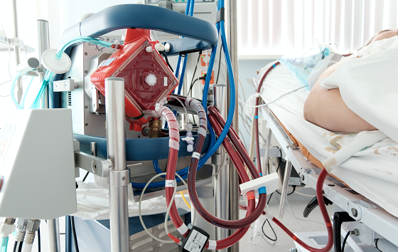 Basics of Extracorporeal Membrane Oxygenation (ECMO)
