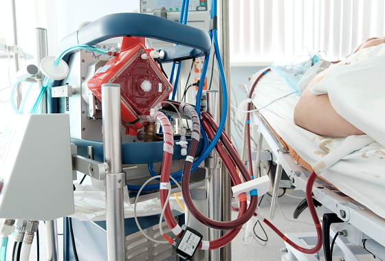 Basics of Extracorporeal Membrane Oxygenation (ECMO)