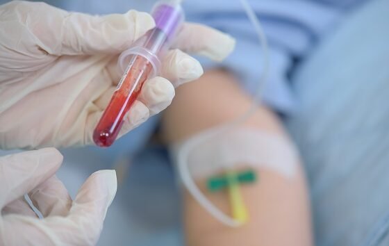 How to calculate absolute neutrophil count