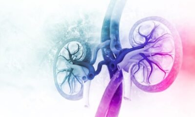 Acute Kidney Injury and Chronic Kidney Disease – What’s the Difference?