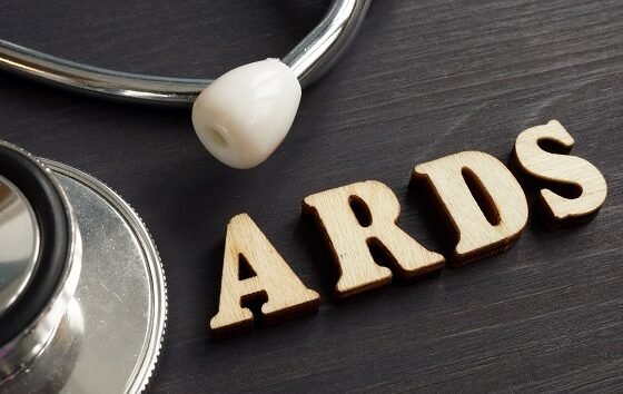 Calculating the severity of acute respiratory distress syndrome (ARDS)