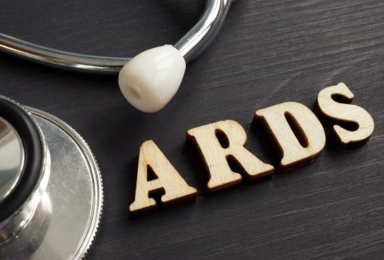 Calculating the severity of acute respiratory distress syndrome (ARDS)