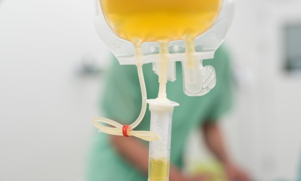 Convalescent plasma therapy – is it an effective method of treating COVID-19?