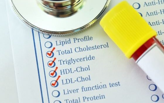 HDL vs. LDL Cholesterol: Understanding Your Lipid Profile