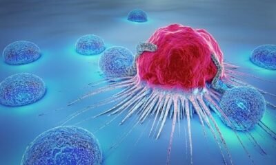 How are cancer cells different from normal cells?