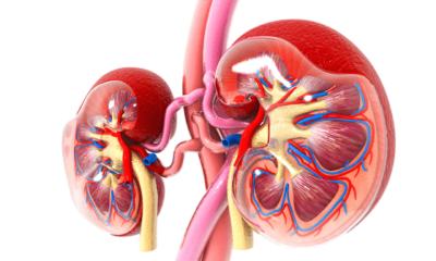 How helpful is fractional sodium excretion?