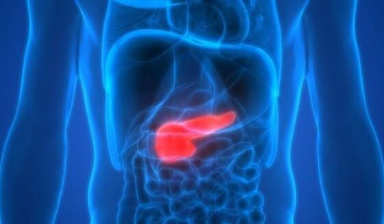 How sick is my pancreatitis patient?