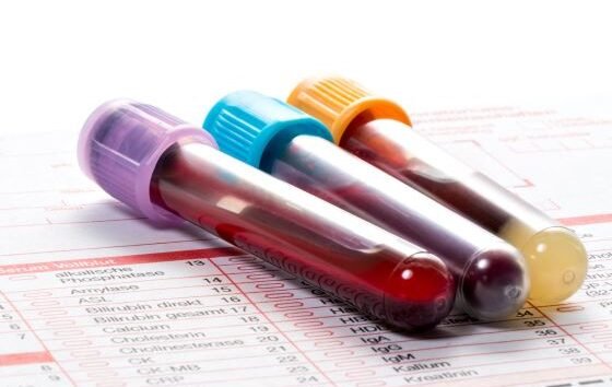 How to Calculate Anion Gap and Identify Anion Gap Acidosis
