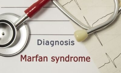 Marfan Syndrome: One Nurse's Story