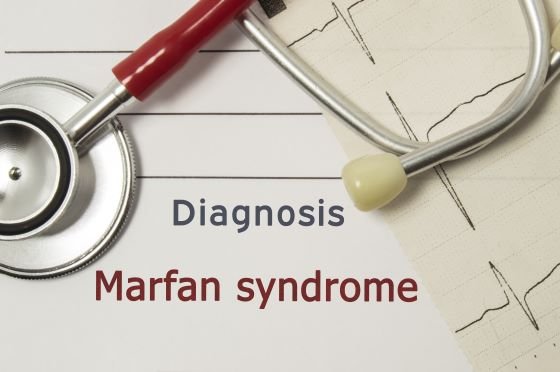 Marfan Syndrome: One Nurse's Story